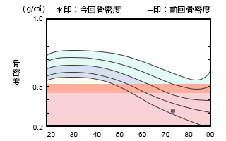 POINT01 骨粗しょう症検査が可能！