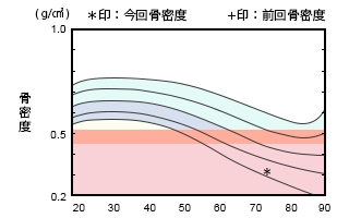 グラフ